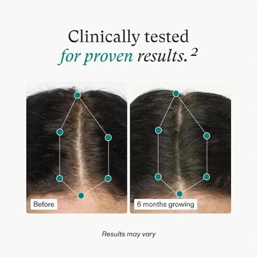 Nutrafol Women's Balance Hair Growth Supplement - 1 Month Supply 120 Capsules